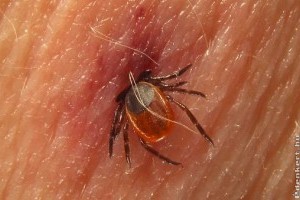 Mit kell tudni a kullancsról? Mi az a Lyme - kór?